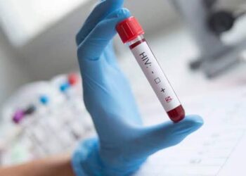 Nova variante do HIV circula em três estados do Brasil, diz estudo