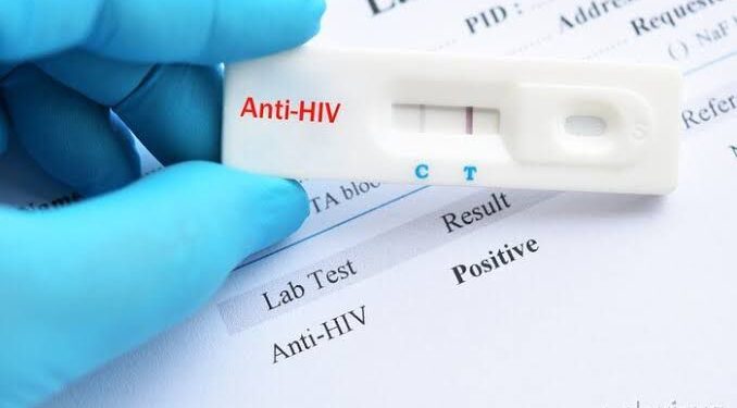 Alagoas registra aumento de 11,89% nos casos de HIV este ano