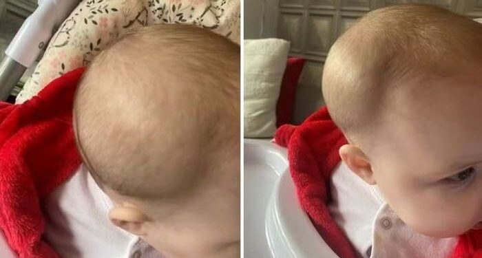 Mãe descobre fratura no crânio da filha ao buscá-la em creche